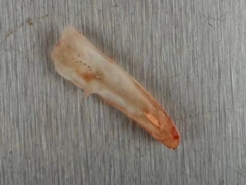 Case 4 procedure — removing back portion of root