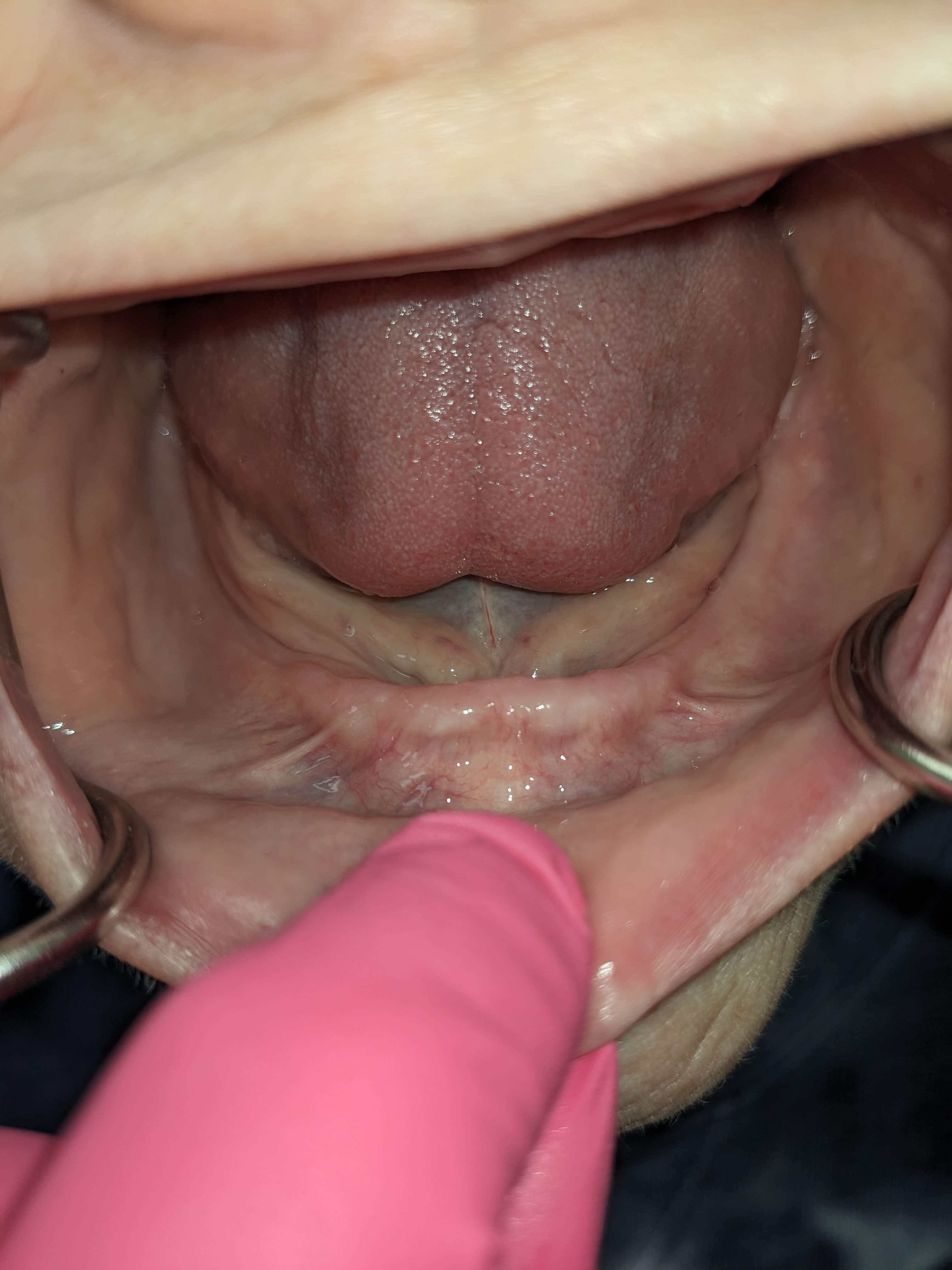 Case 3 additional before — pre-treatment